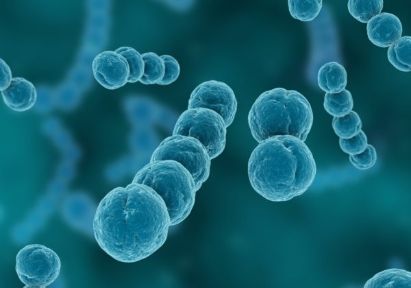 legionella