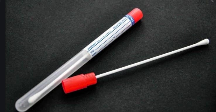 tampone quarantena